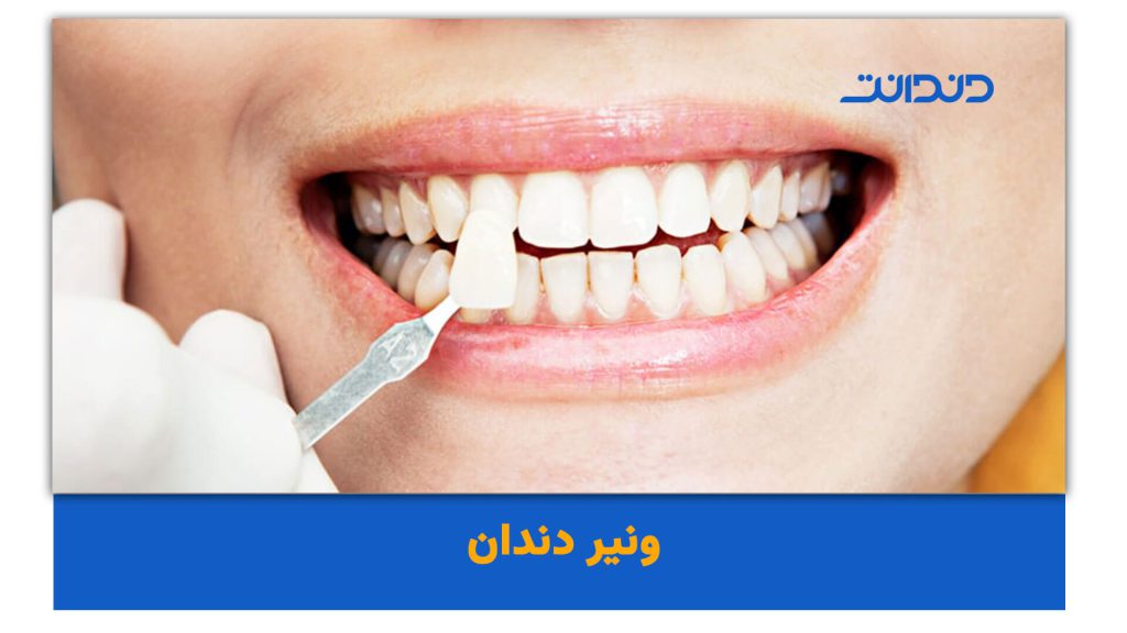 Khám Phá Thế Giới Giải Trí Trực Tuyến Với Gái Vàng Ngày Hôm Nay Hướng Dẫn Chi Tiết Và Kinh Nghiệm Cá Nhân